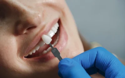 The Benefits of Dental Implants Over Traditional Tooth Replacement Options