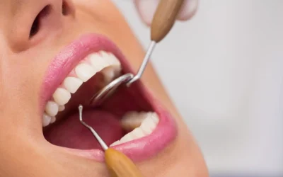 Why You Should Never Skip Your Dental Cleanings: What Really Happens During a Prophylaxis
