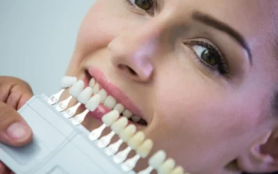 Dental Crowns vs. Veneers: Which One Should You Choose for a Smile Makeover?